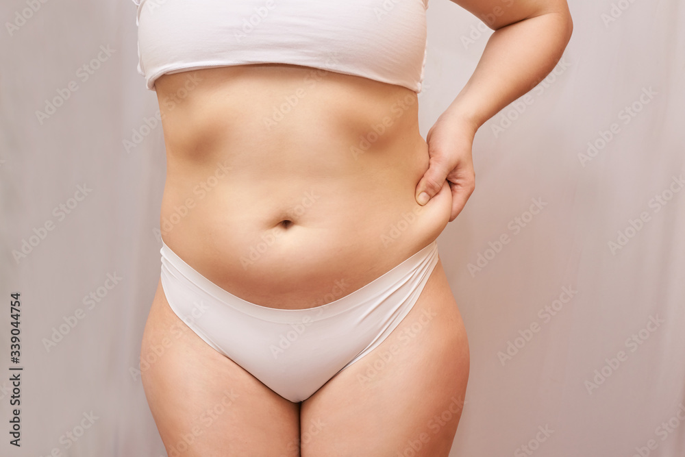 Mulher mostrando gordura localizada no próprio corpo